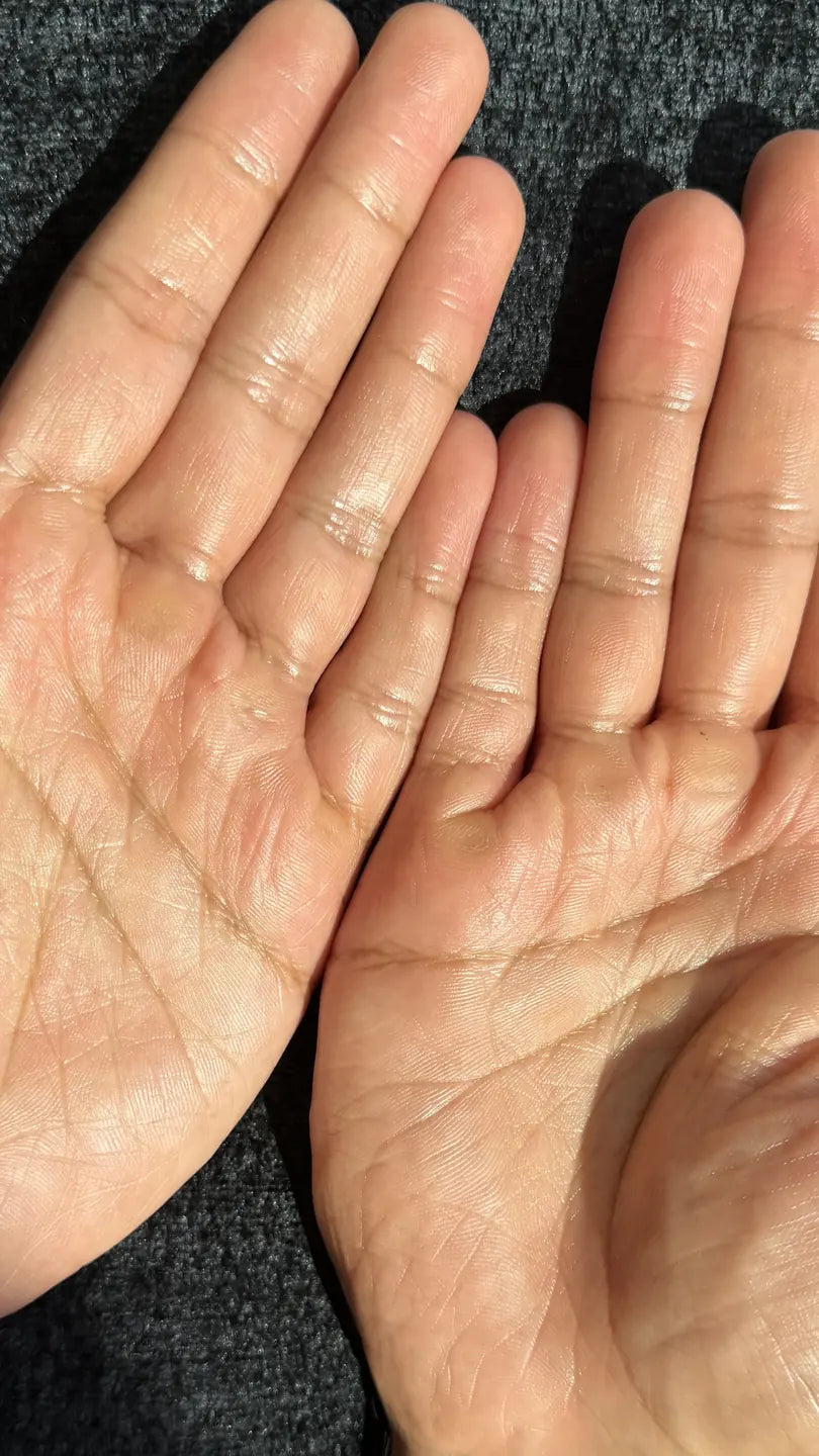 Palms after 1 use