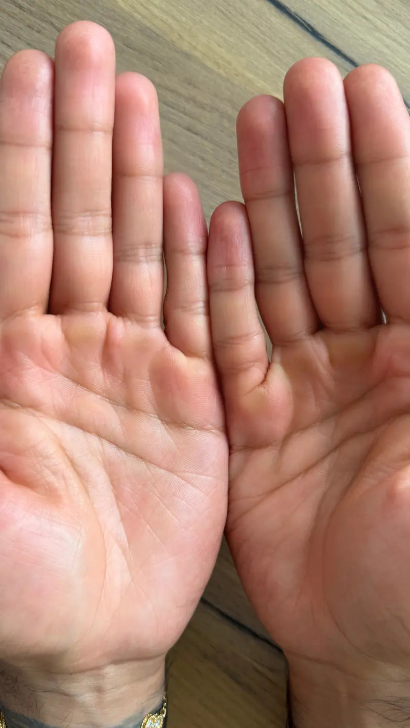 Palms after 10 uses
