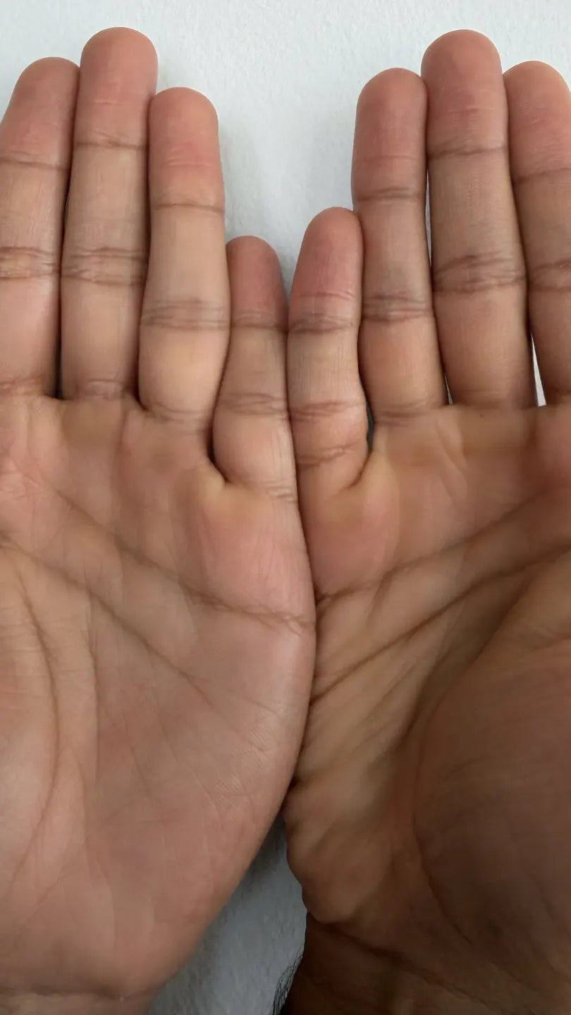 Palms after 4 uses